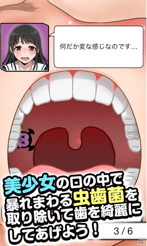 虫歯菌と戦う萌えSLG「歯みがき彼女◆Cavity Kanojo」がiOS/Android向けに配信！記念キャンペーンも開催中の画像3